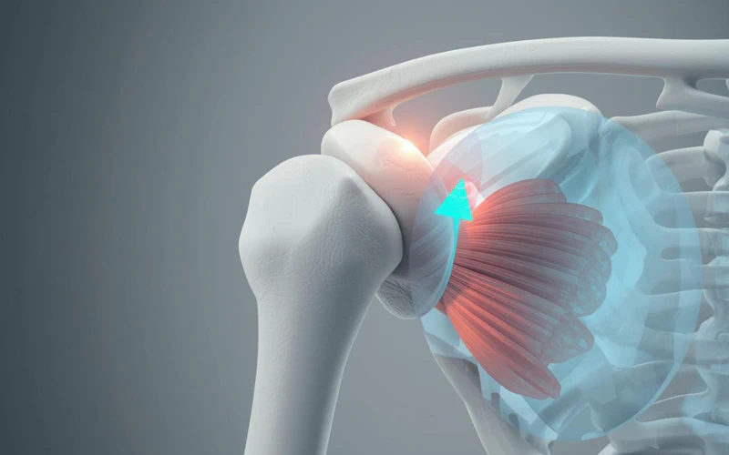 Mobilnost Ramena: Biomehanički Pristup Prevenciji Impingementa i Poboljšanju Pokretljivosti